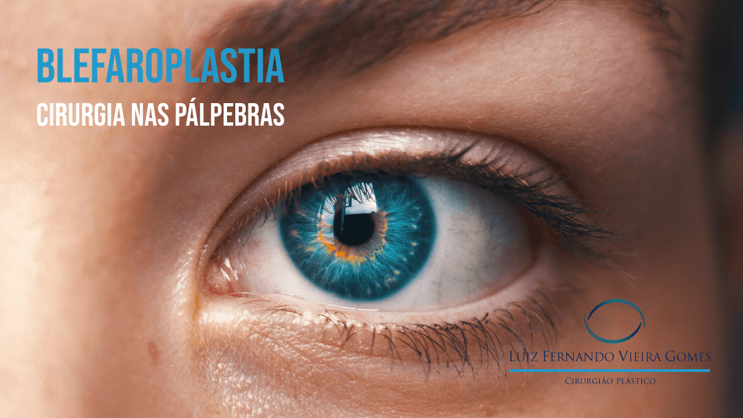 Blefaroplastia